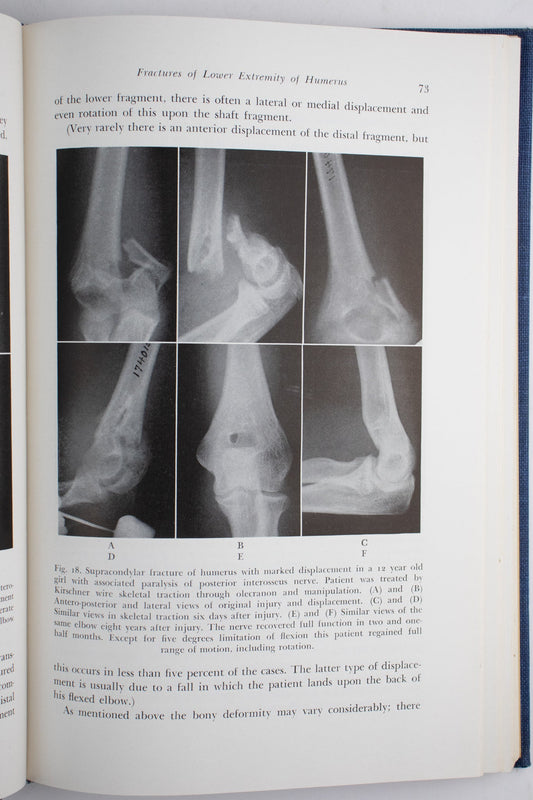 Surgery of the Elbow - Books from Stemcell Science Shop