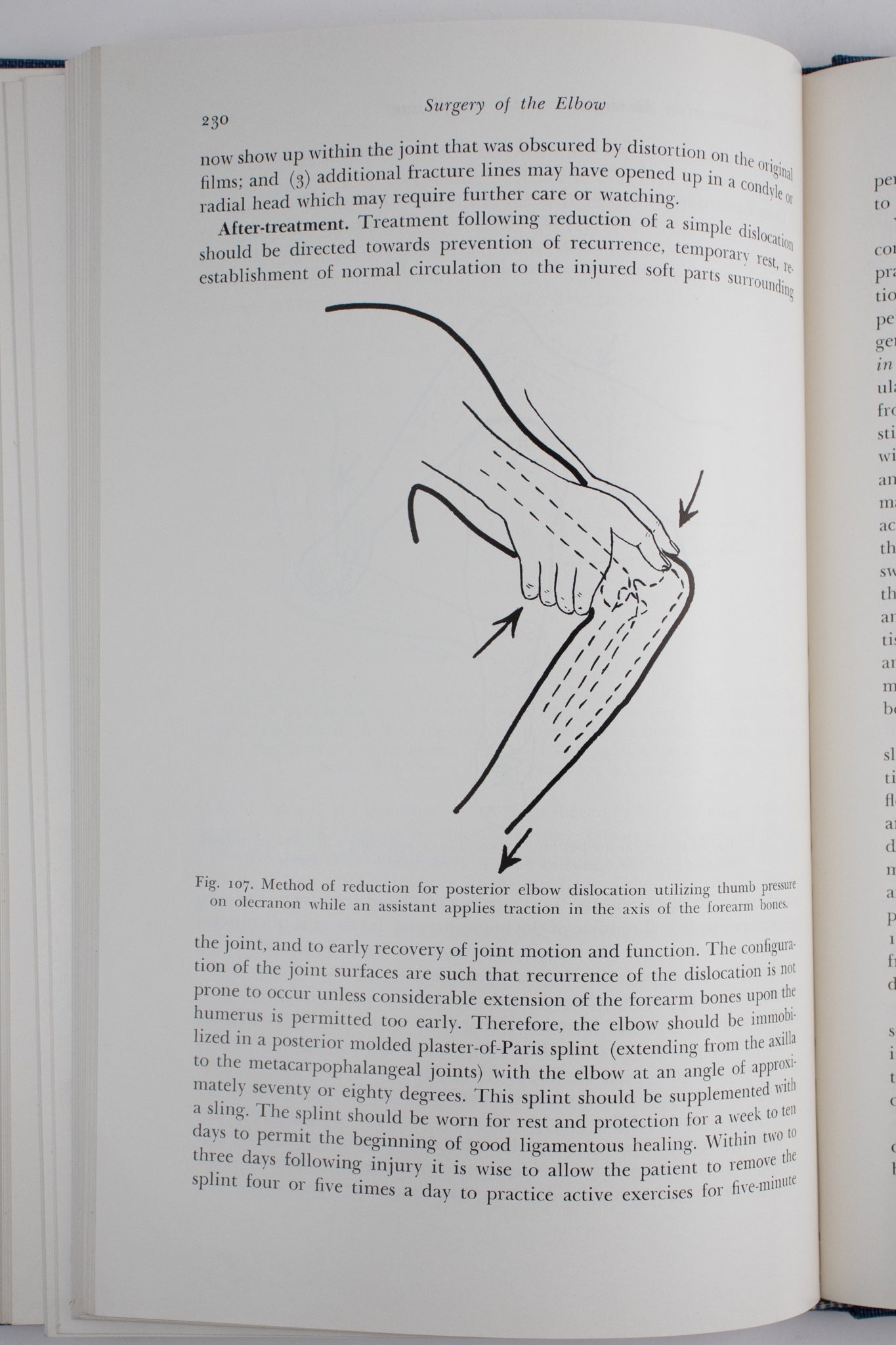 Surgery of the Elbow - Books from Stemcell Science Shop
