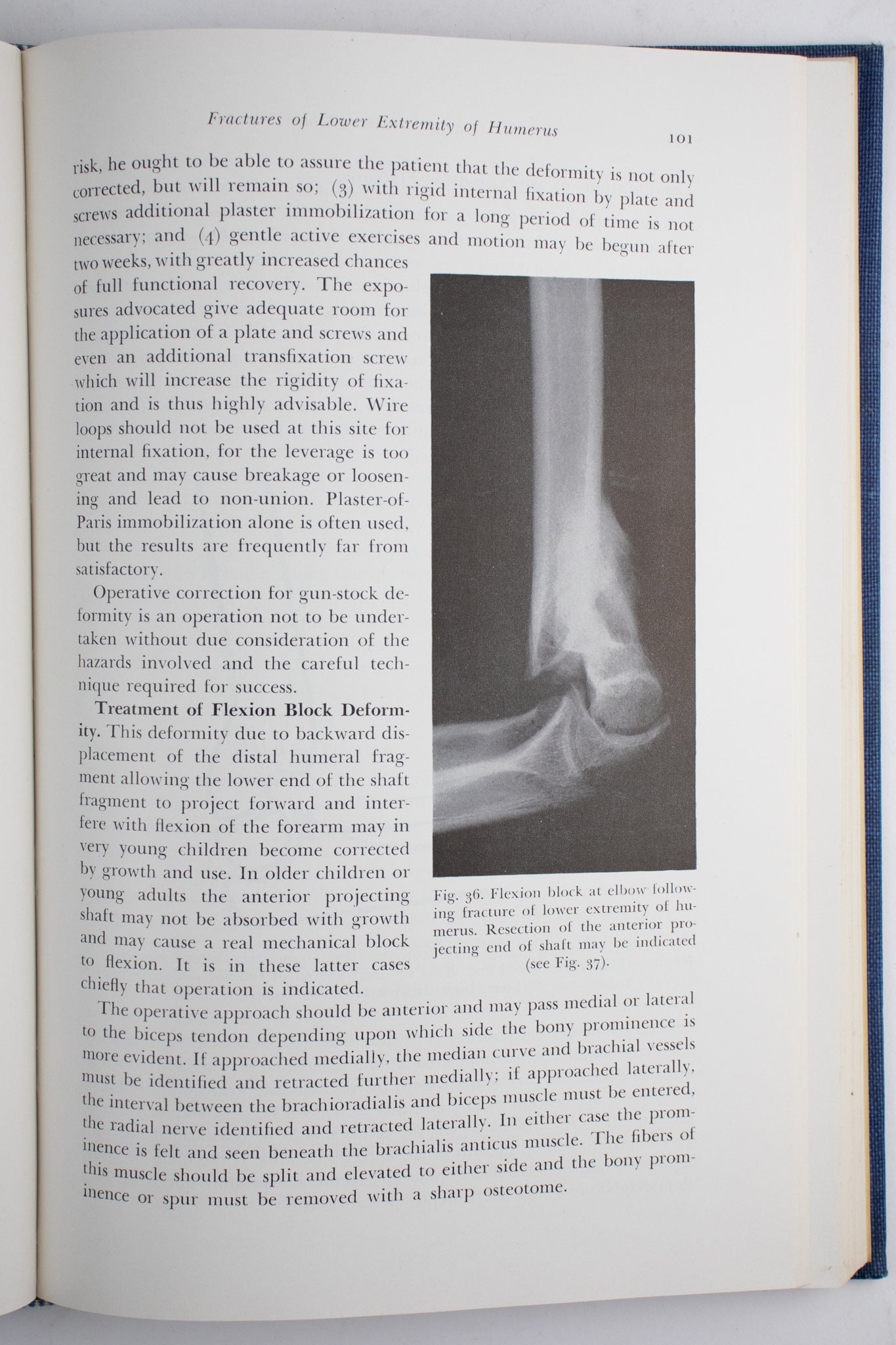 Surgery of the Elbow - Books from Stemcell Science Shop
