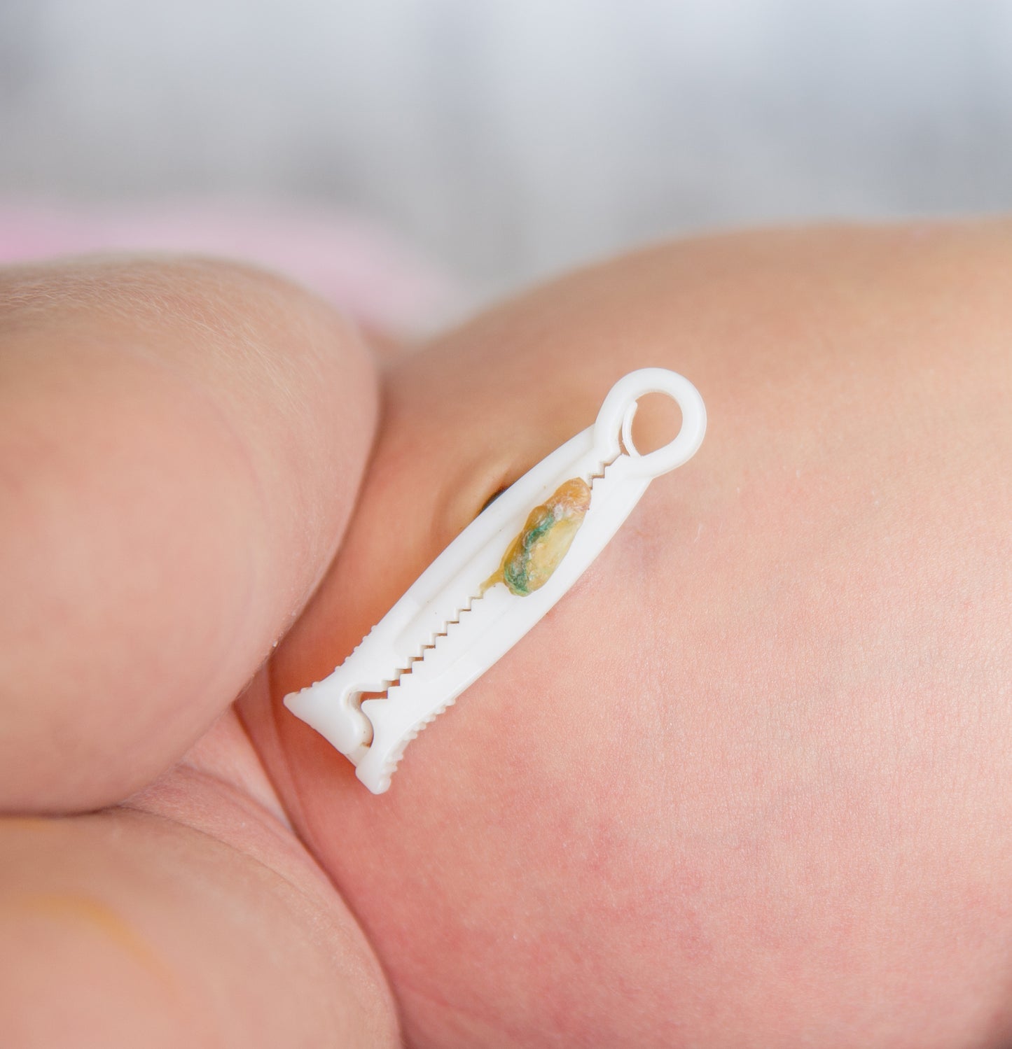 Umbilical Clamp - 10/pk