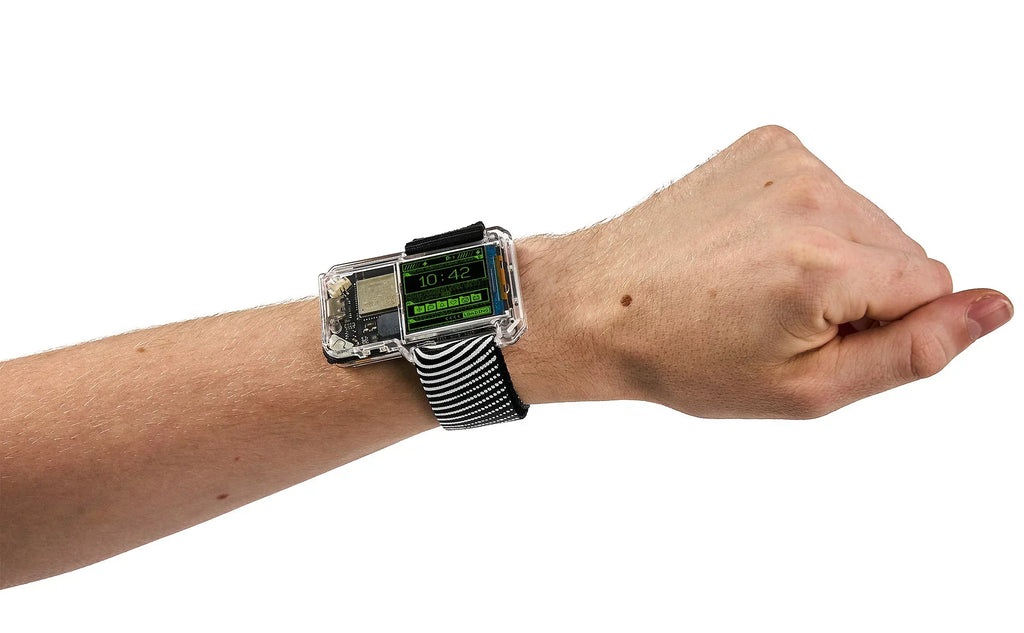 Artemis Watch Strap: Starlight