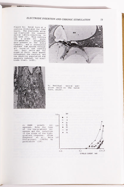 Cochlear Implants
